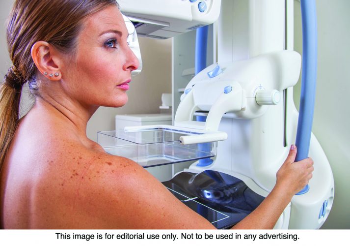 Is a Three-Dimensional Mammogram Right For You?